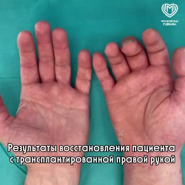Миниатюра видео